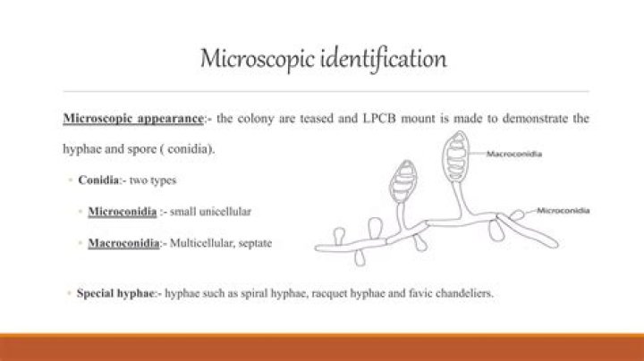What is Macroconidia and Microconidia?