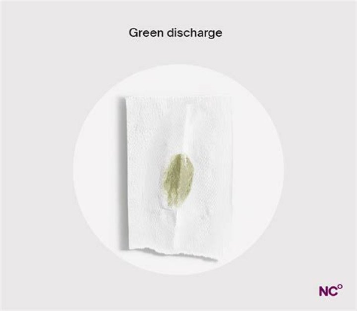 What is malodorous discharge?