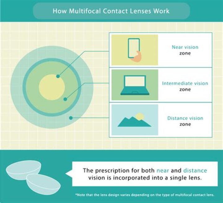 What is multifocal TB?
