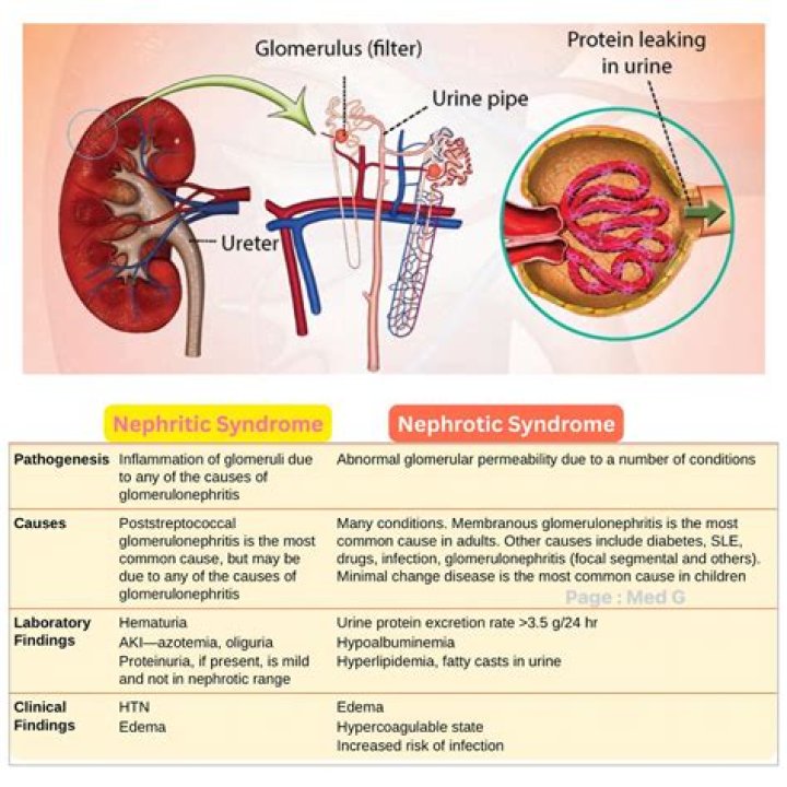 What is nephrotic and nephritic?