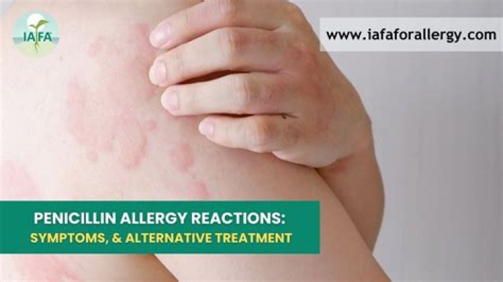What is Parthenolide allergy?