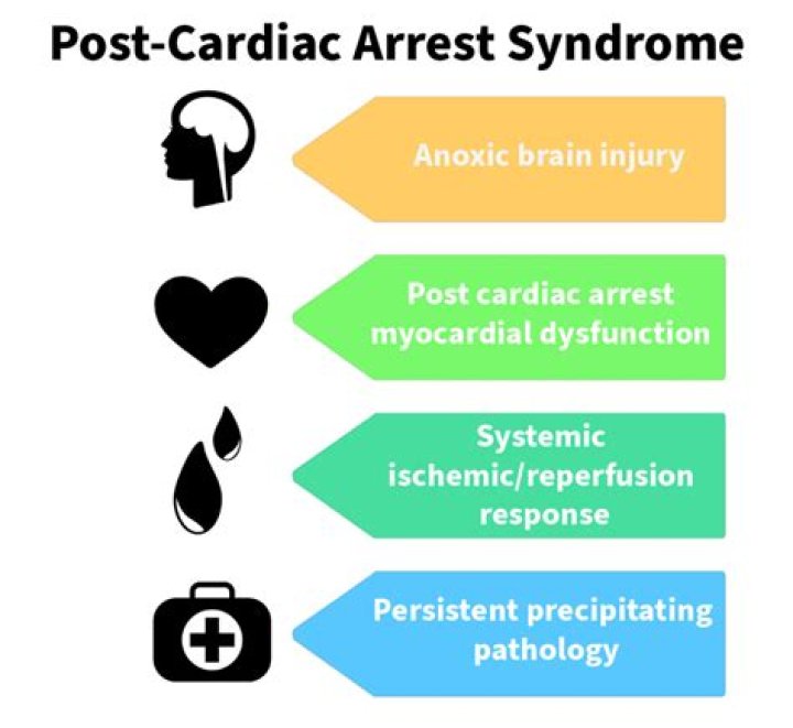 What is post cardiac arrest syndrome?