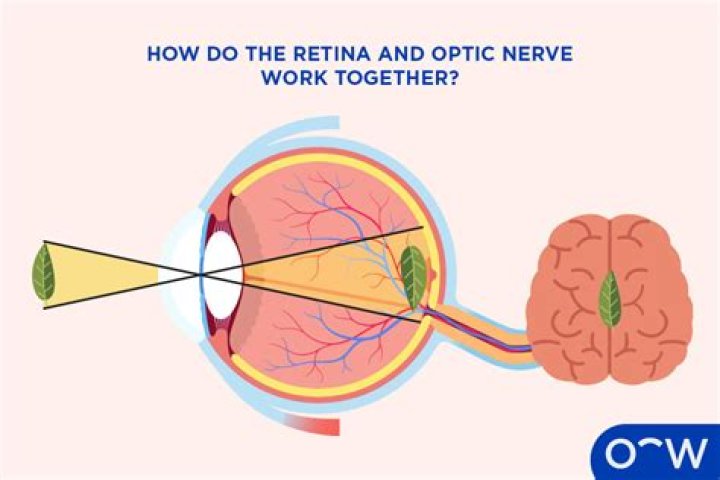 What is retina evaluation?