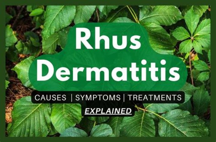 What is Rhus dermatitis?