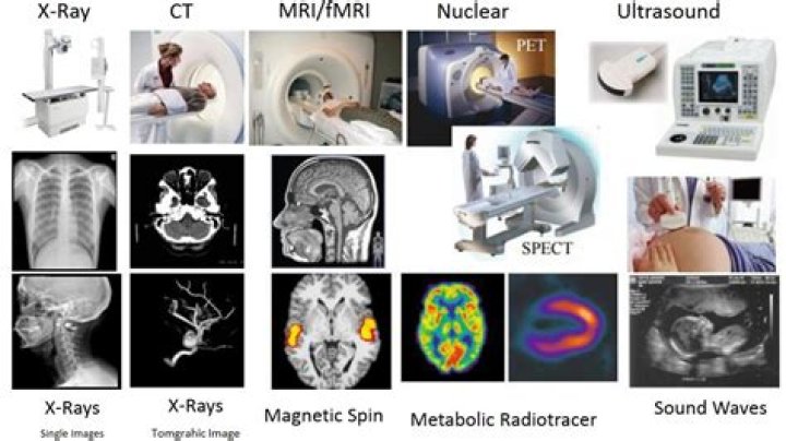 What is the best radiology field?