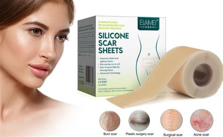 What is the best silicone gel for keloids?