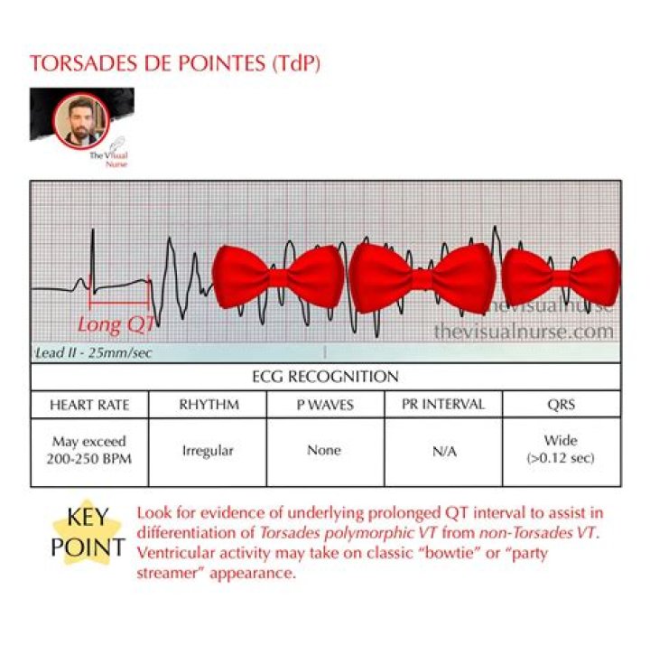 What is the best treatment for torsades de pointes?