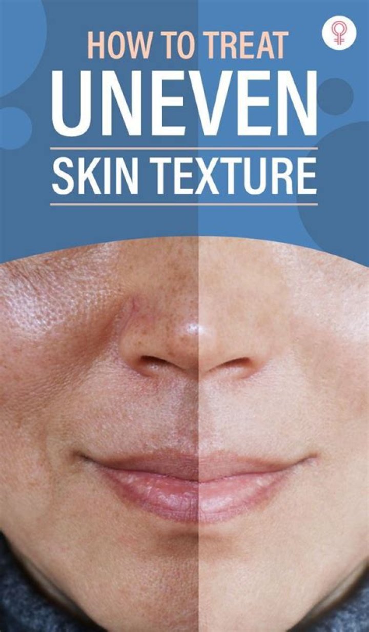 What is the best treatment for uneven skin texture?