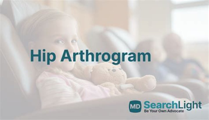 What is the CPT code for hip arthrogram?