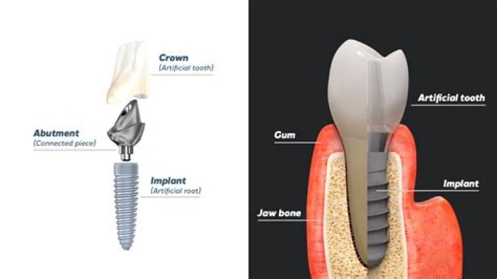 What is the dental association called?