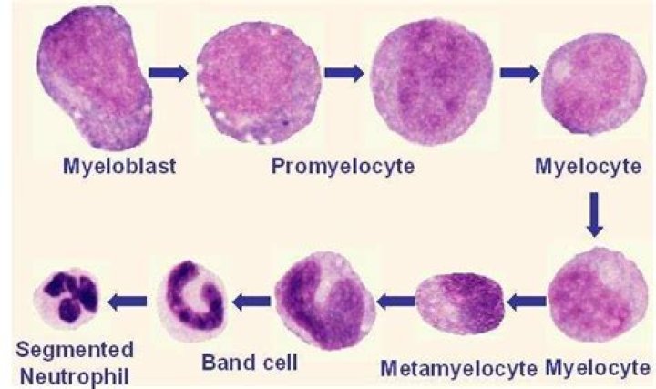 What is the difference between myeloblast and Promyelocyte?