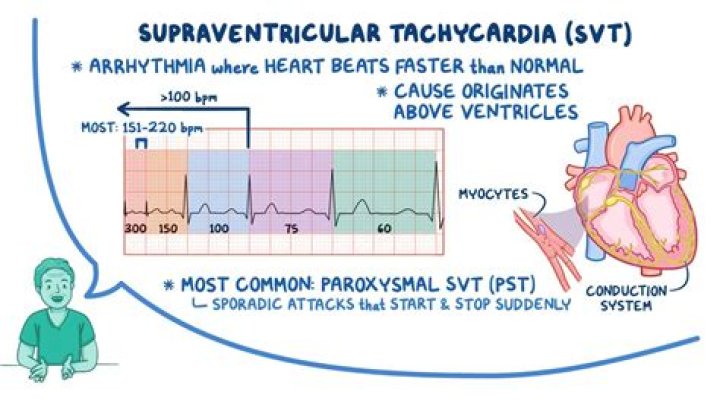 What is the difference between sinus tachycardia and ventricular tachycardia?