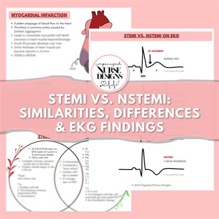 What is the difference between STEMI and NSTEMI treatment?