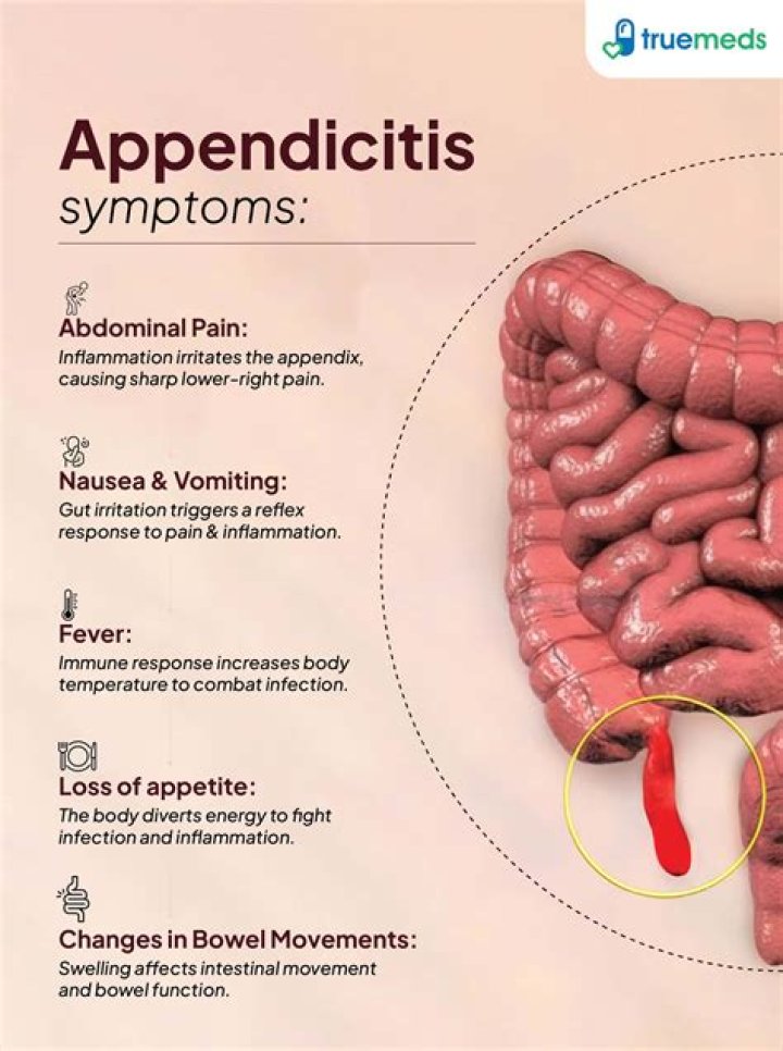 What is the histological hallmark for the diagnosis of acute appendicitis?