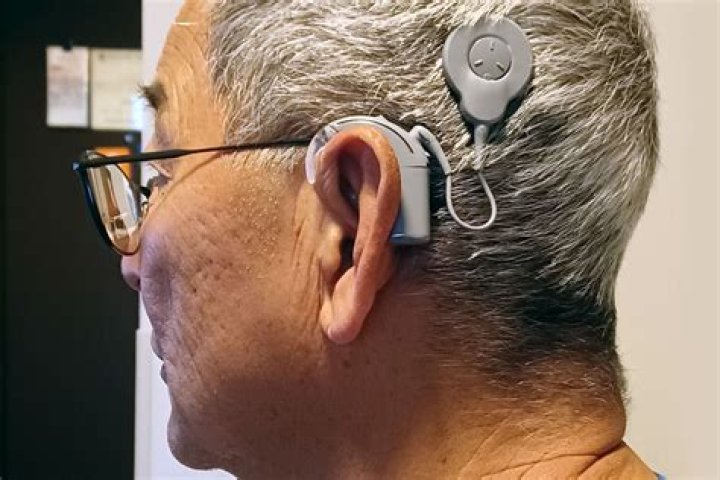 What is the latest cochlear implant processor?
