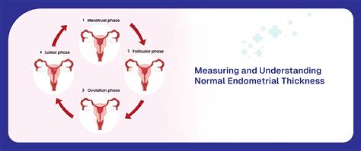 What is the meaning of Myometrial mass?