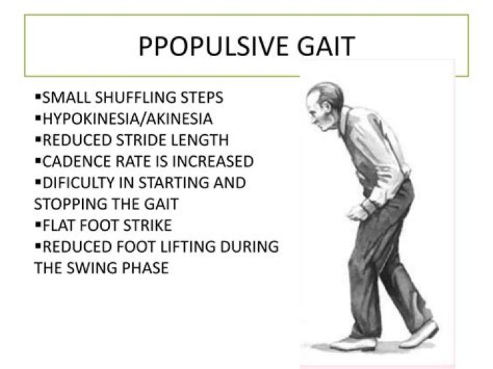 What is the meaning of shuffling of feet?