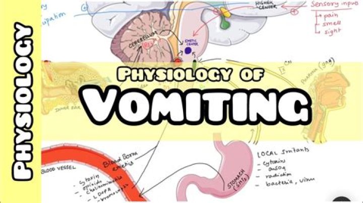 What is the medical definition for vomiting?