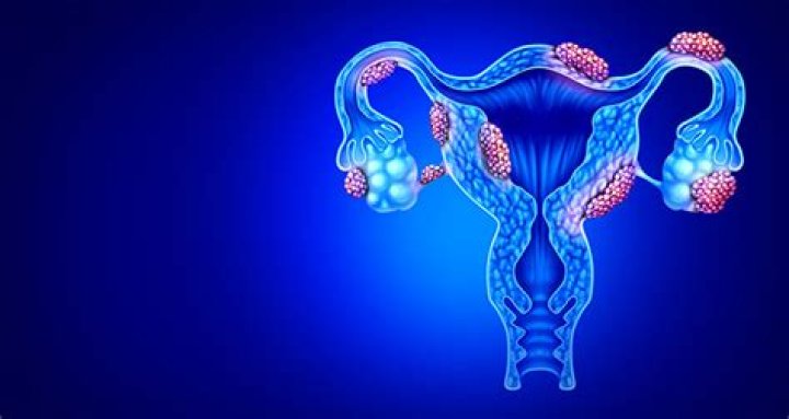 What is the most common tumor of the uterus?