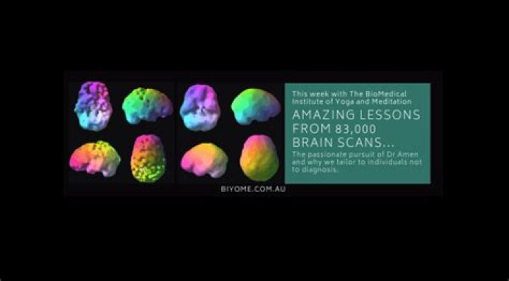 What is the most important lesson from 83000 brain scans?