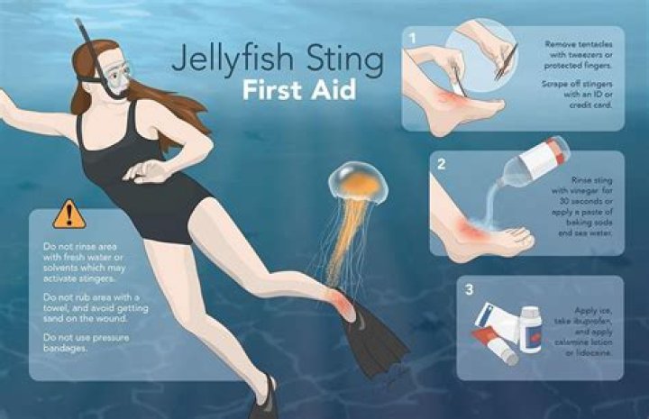 What is the most painful jellyfish sting?