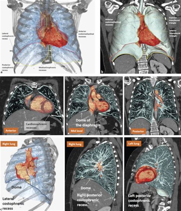 What is the purpose of costomediastinal recess?