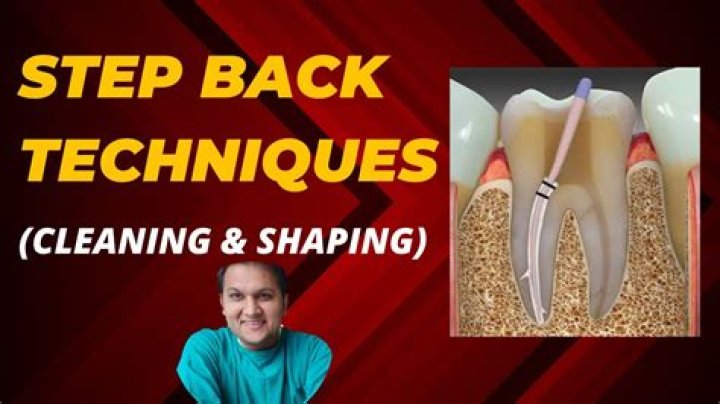 What is the step-back technique in endodontics?
