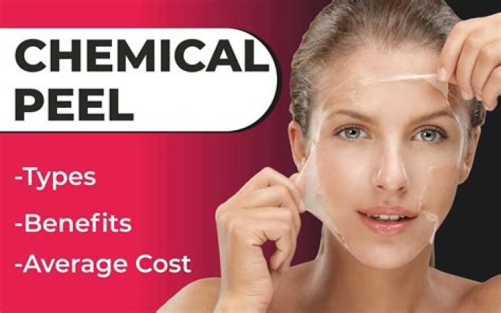 What is the strongest chemical peel for home?