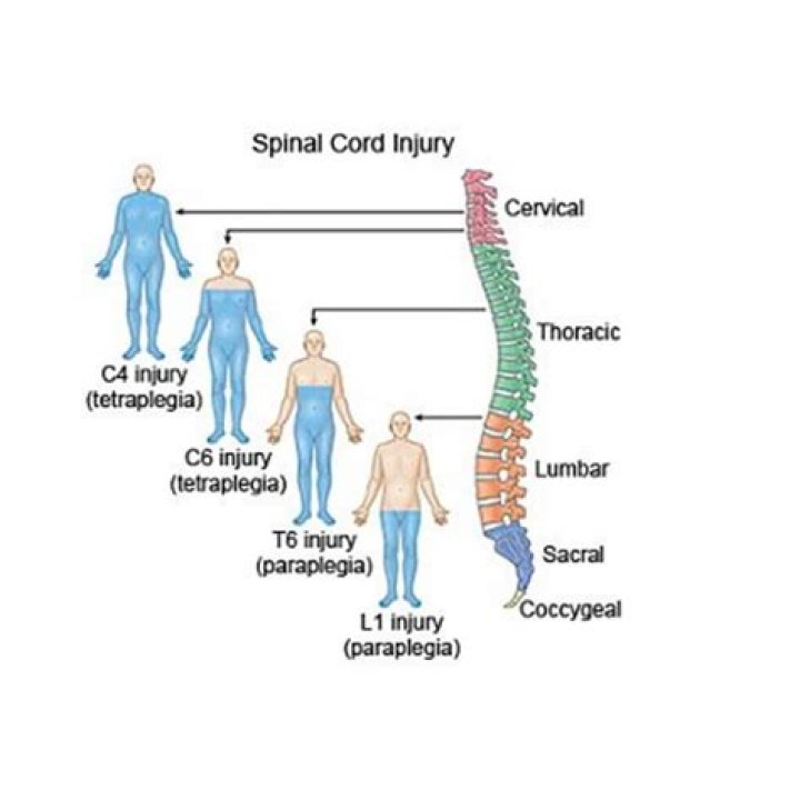 What is the system that can be used by someone with quadriplegia?
