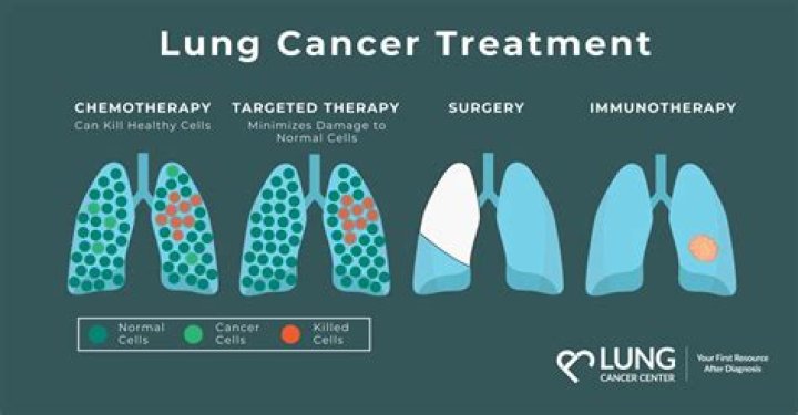 What is the treatment for parotid cancer?