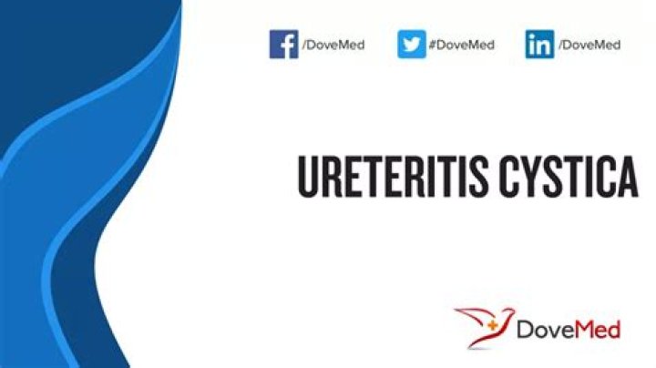 What is ureteritis cystica?