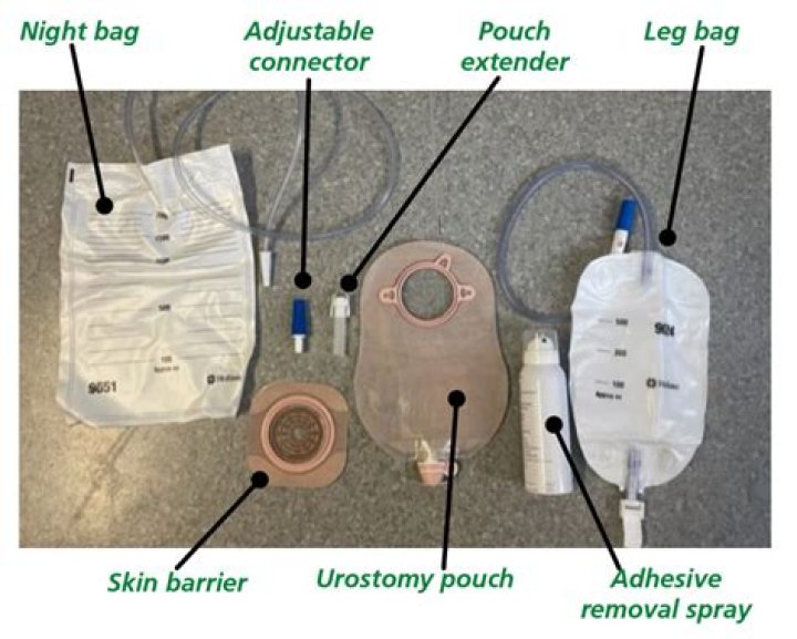 What is urostomy tube?