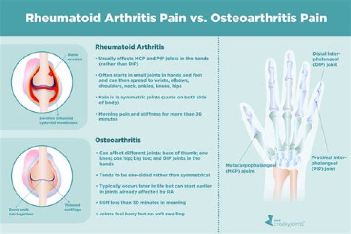 What is worse rheumatoid arthritis or psoriatic arthritis?