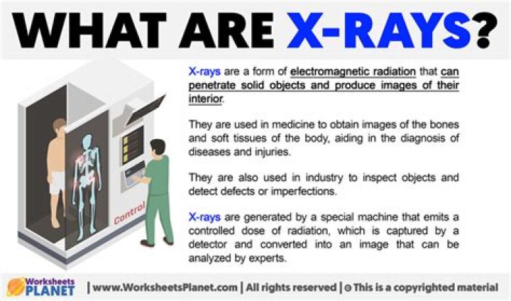 What jobs use X rays?