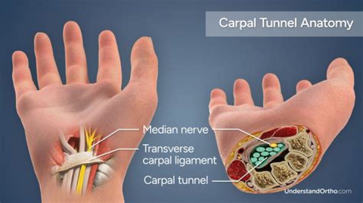 What muscles are weak in carpal tunnel syndrome?