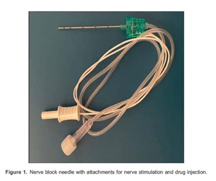 What needle is used for nerve block?
