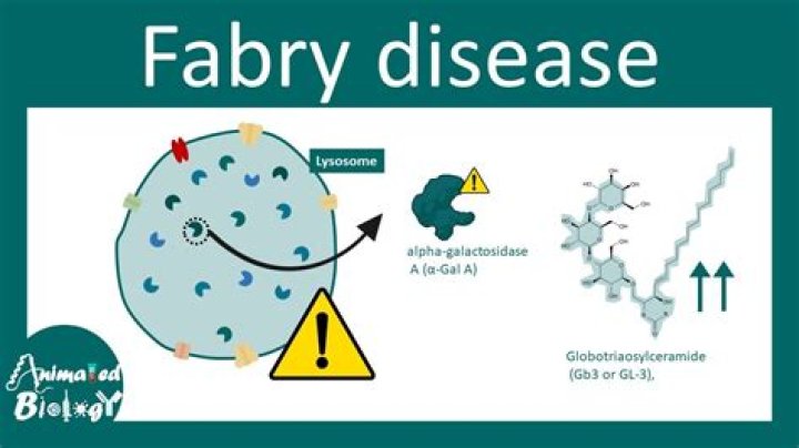 What other names are there for Fabry disease?