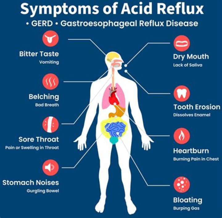 What percentage does the VA give for acid reflux?