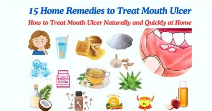 What supplements are good for mouth ulcers?