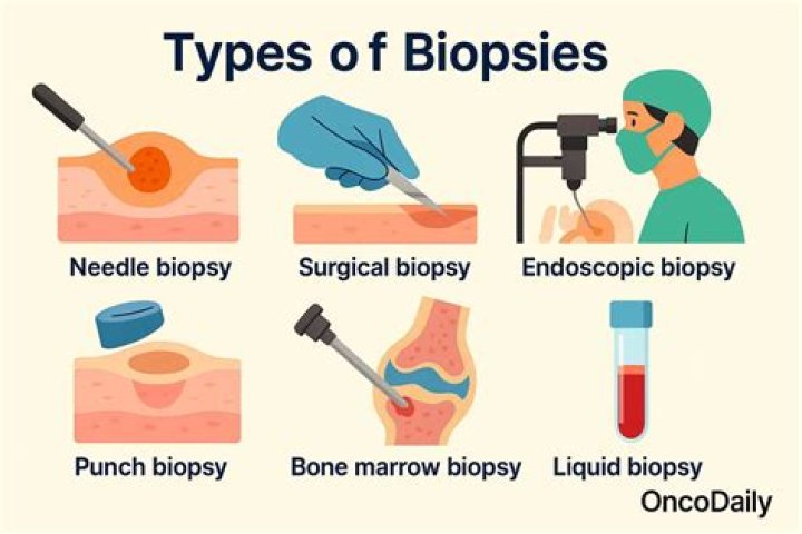 What will a duodenum biopsy show?