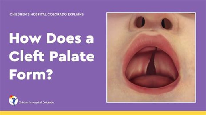 When does the soft palate close?