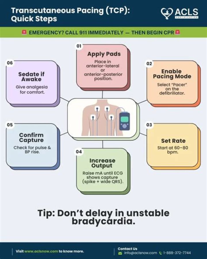 When is DDD pacing used?