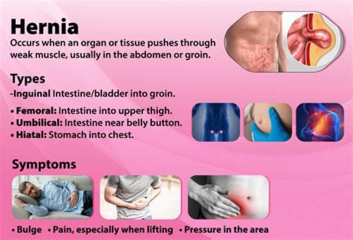 When should I worry about a hernia in my stomach?