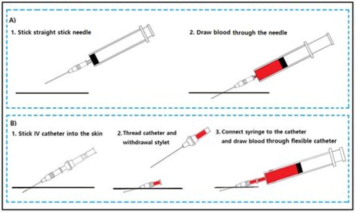 Where do you hold a needle?