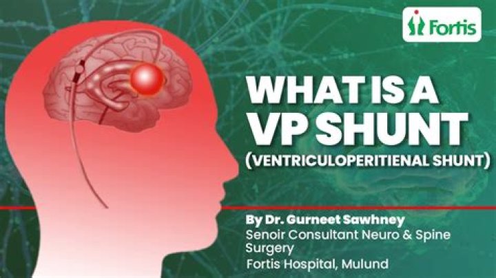 Where do you put a VP shunt?