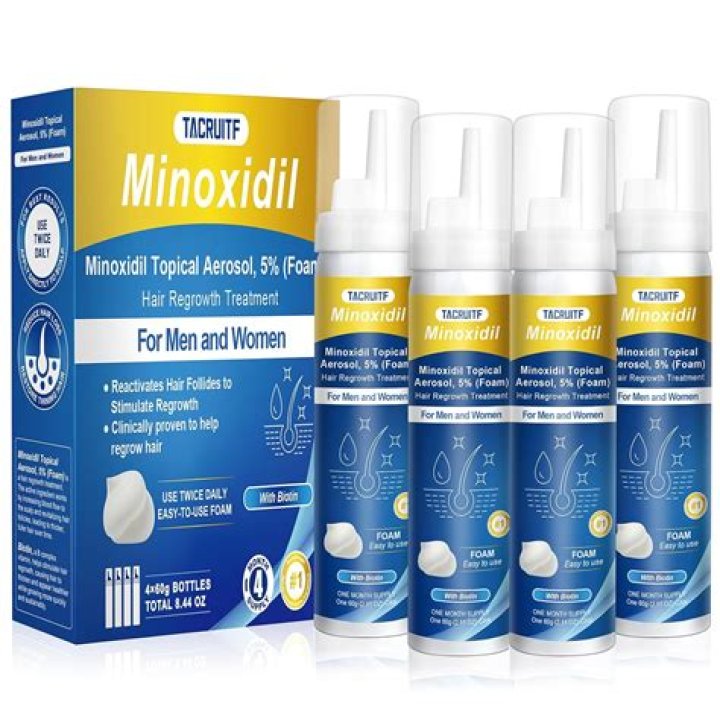 Which is better minoxidil or Mintop?