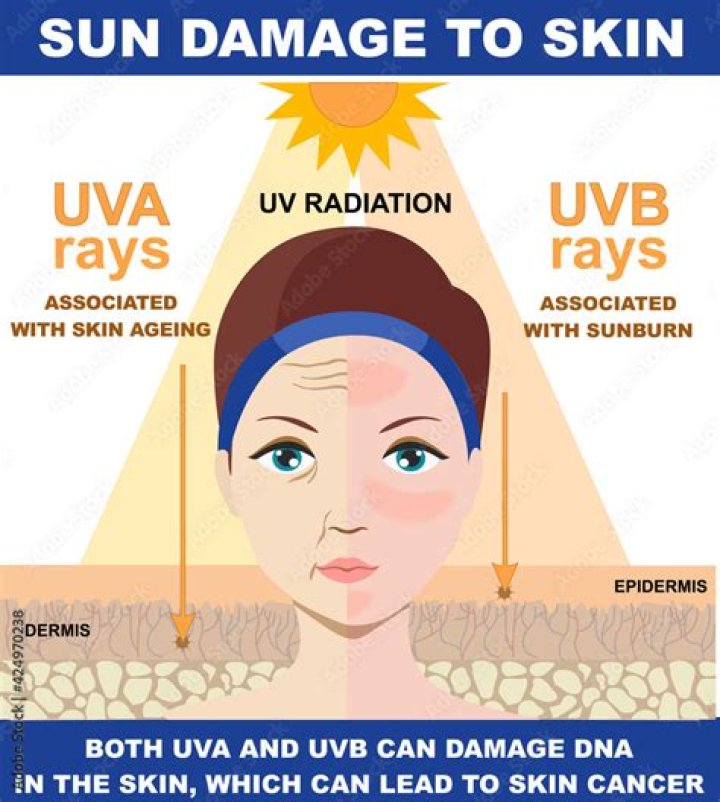 Which type of rays cause skin aging?