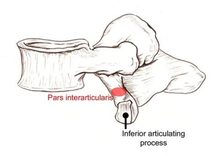 Which vertebrae have pars Interarticularis?