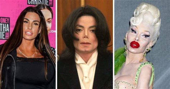 Who is the man with the most plastic surgery?