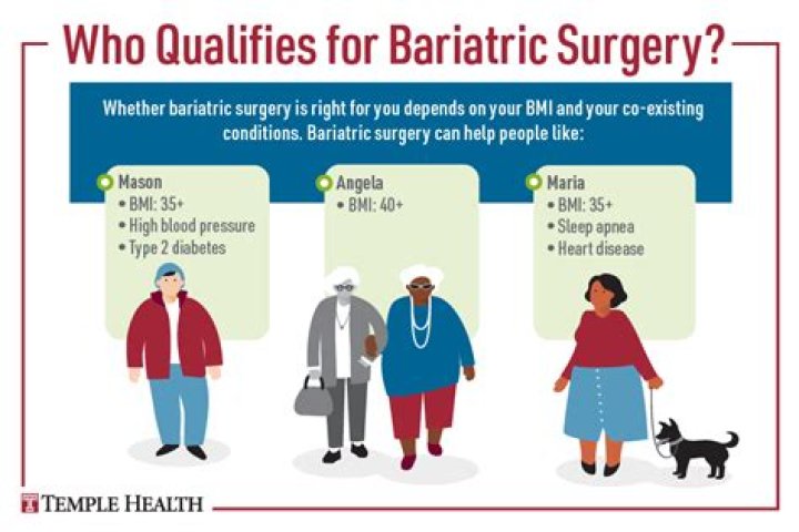 Who qualifies for bariatric?